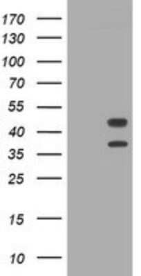 Western Blot: STING/TMEM173 Antibody (OTI4H1)Azide and BSA Free [NBP2-74402]