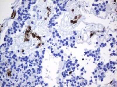 Immunohistochemistry: STING/TMEM173 Antibody (OTI4H1) [NBP2-45998]