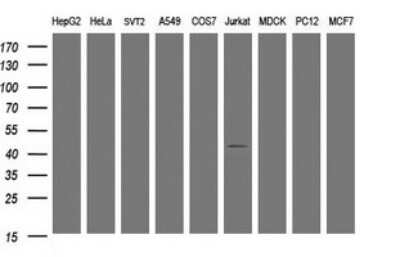 Western Blot: STING/TMEM173 Antibody (OTI4H1) [NBP2-45998]