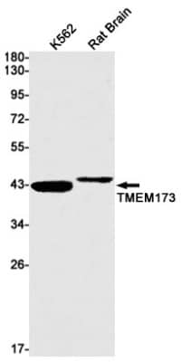 Western Blot: STING/TMEM173 Antibody (S06-9A7) [NBP3-19785]