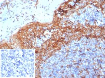 Immunohistochemistry-Paraffin: STING/TMEM173 Antibody (STING1/7432) [NBP3-13942]