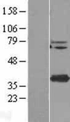 Western Blot: STING/TMEM173 Overexpression Lysate [NBL1-17038]