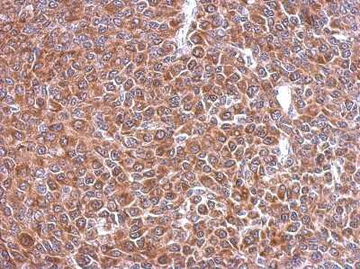 Immunohistochemistry-Paraffin: STI1 Antibody [NBP2-20512]