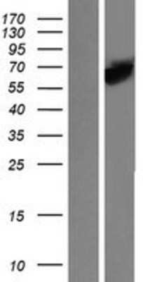 Western Blot: STI1 Overexpression Lysate [NBP2-07574]