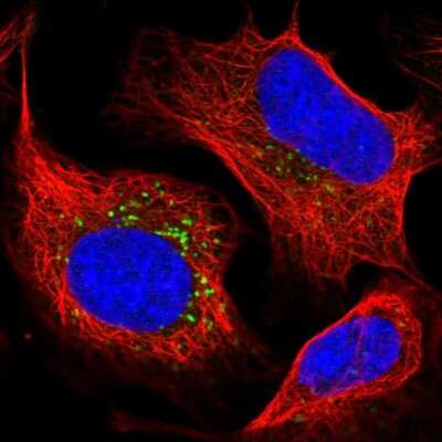 Immunocytochemistry/ Immunofluorescence: STK11IP Antibody [NBP1-92451]