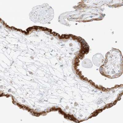 Immunohistochemistry-Paraffin: STK11IP Antibody [NBP1-82885]