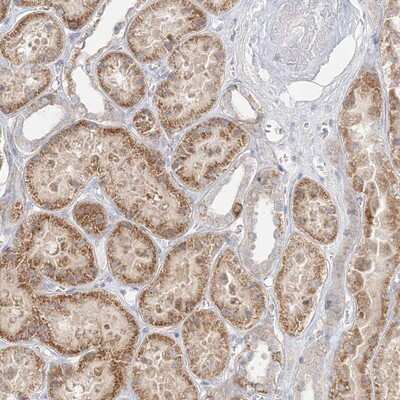Immunohistochemistry-Paraffin: STK11IP Antibody [NBP1-92451]