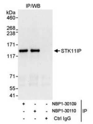 Immunoprecipitation: STK11IP Antibody [NBP1-30109]