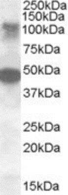 Western Blot: STK11IP Antibody [NBP1-28481]