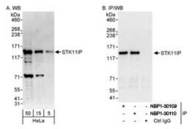 Western Blot: STK11IP Antibody [NBP1-30110]