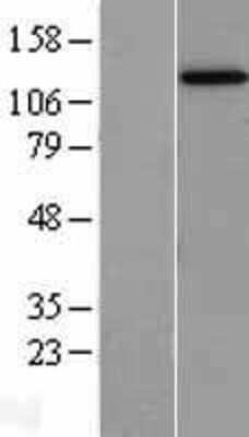 Western Blot: STK11IP Overexpression Lysate [NBL1-16541]