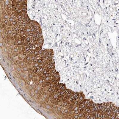 Immunohistochemistry-Paraffin: STK16 Antibody [NBP1-81040]