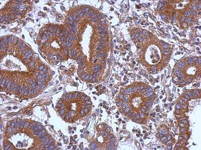 Immunohistochemistry-Paraffin: STK16 Antibody [NBP2-20514]