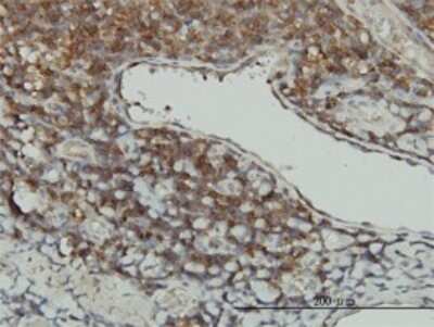 Immunohistochemistry-Paraffin: STK16 Antibody (M2) [H00008576-M02]