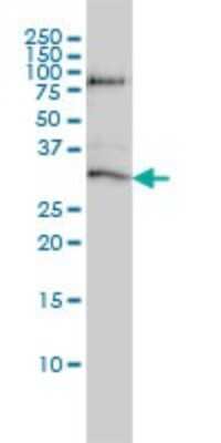 Western Blot: STK16 Antibody (M2) [H00008576-M02]