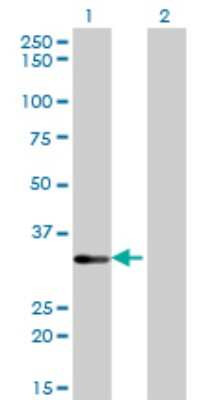 Western Blot: STK16 Antibody (M2) [H00008576-M02]