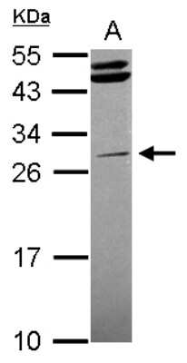 Western Blot: STK16 Antibody [NBP2-20513]