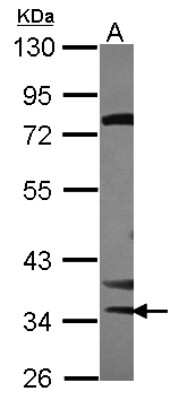 Western Blot: STK16 Antibody [NBP2-20514]