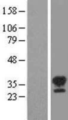 Western Blot: STK16 Overexpression Lysate [NBL1-16543]
