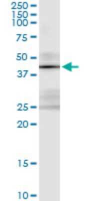 Immunoprecipitation: STK19 Antibody (4E11) [H00008859-M01]