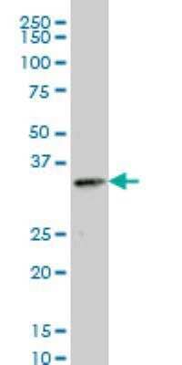 Western Blot: STK19 Antibody (4E11) [H00008859-M01]