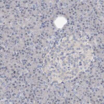 Immunohistochemistry-Paraffin: STK19 Antibody [NBP1-84308]
