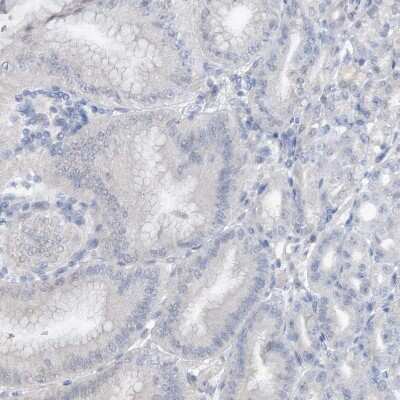 Immunohistochemistry-Paraffin: STK19 Antibody [NBP1-84308]