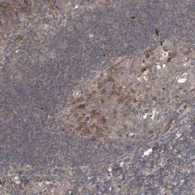 Immunohistochemistry-Paraffin: STK19 Antibody [NBP1-84308]
