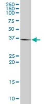 Western Blot: STK19 Antibody [H00008859-B01P]