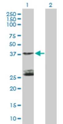 Western Blot: STK19 Antibody [H00008859-B01P]