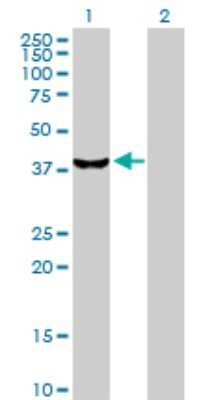 Western Blot: STK19 Antibody [H00008859-D01P]