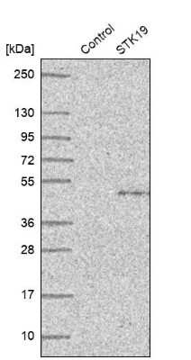 Western Blot: STK19 Antibody [NBP1-84308]