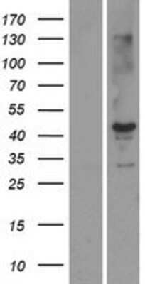 Western Blot: STK19 Overexpression Lysate [NBP2-06016]