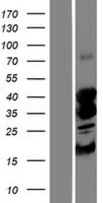 Western Blot: STK19 Overexpression Lysate [NBP2-07899]