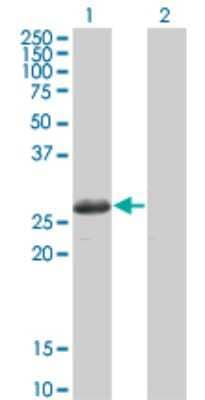 Western Blot: STK22C Antibody (3G8) [H00081629-M02]