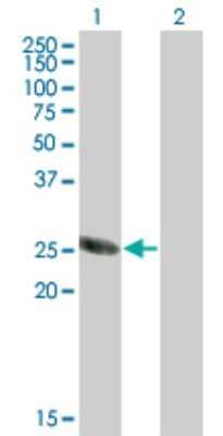 Western Blot: STK22C Antibody (6B2) [H00081629-M07]