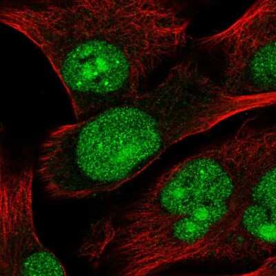 Immunocytochemistry/ Immunofluorescence: STK22C Antibody [NBP2-48674]