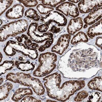 Immunohistochemistry-Paraffin: STK22C Antibody [NBP2-48674]