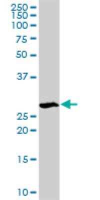 Western Blot: STK22C Antibody [H00081629-D01P]