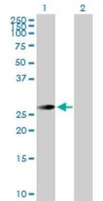 Western Blot: STK22C Antibody [H00081629-D01P]