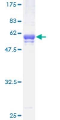 SDS-PAGE: Recombinant Human STK22C GST (N-Term) Protein [H00081629-P01]