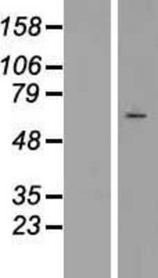 Western Blot: SRPK3/STK23 Overexpression Lysate [NBP2-10326]