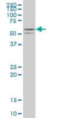 Western Blot: STK25 Antibody (4B10) [H00010494-M02]