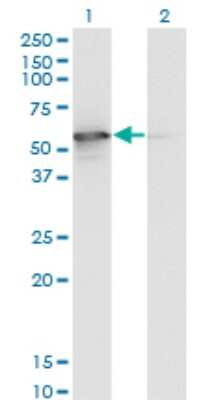 Western Blot: STK25 Antibody (4B10) [H00010494-M02]