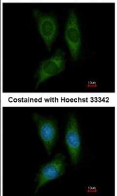 Immunocytochemistry/ Immunofluorescence: STK25 Antibody [NBP1-32670]