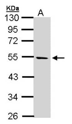 Western Blot: STK25 Antibody [NBP1-32670]