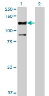 Western Blot: STK31 Antibody (1C10) [H00056164-M02]