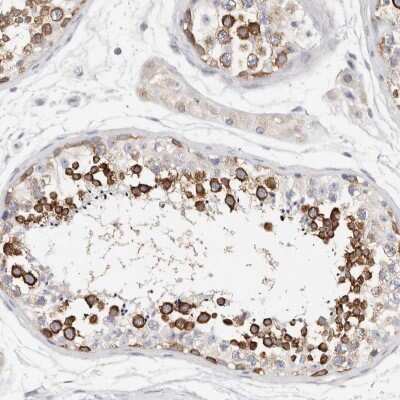Immunohistochemistry-Paraffin: STK31 Antibody [NBP1-80759]