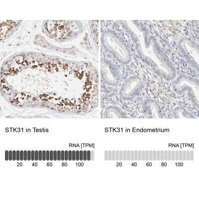 Immunohistochemistry-Paraffin: STK31 Antibody [NBP1-80759]