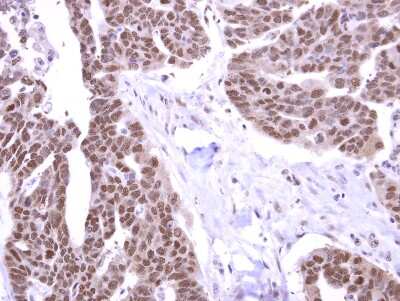 Immunohistochemistry-Paraffin: STK31 Antibody [NBP2-19305]